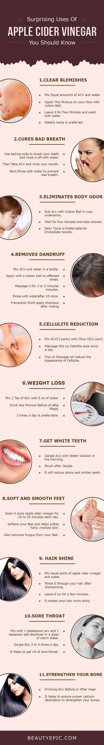 6 Amazing Beauty Benefits Of Apple Cider Vinegar
