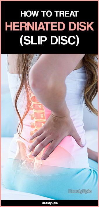 How To Cure Slip Disc