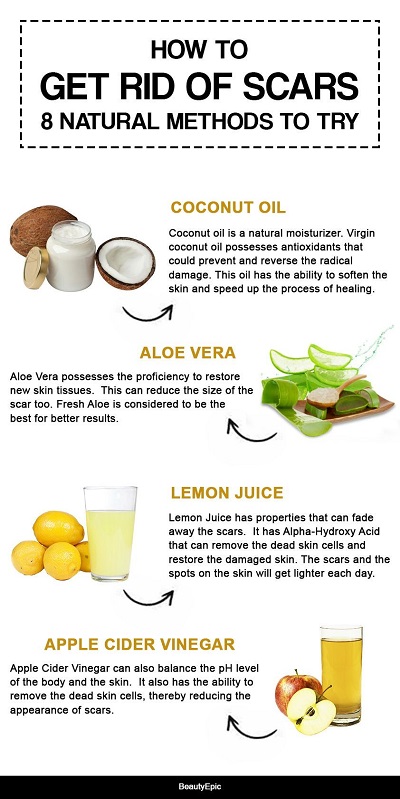 How To Get Rid Of Scars