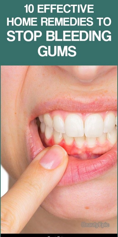 How to Treat Bleeding Gums
