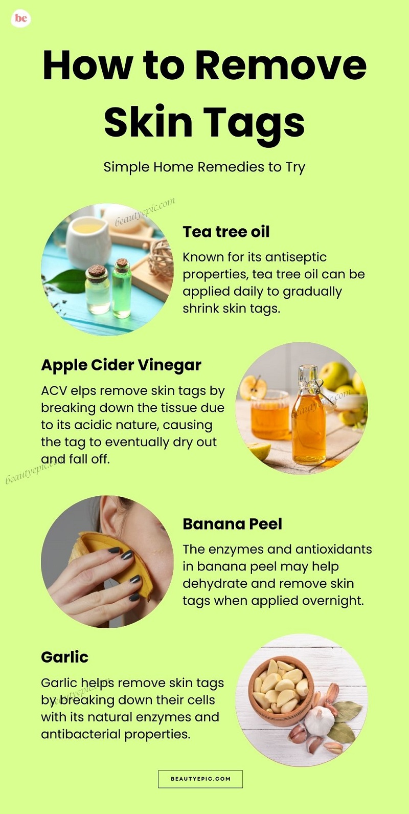 How to Remove Skin Tags