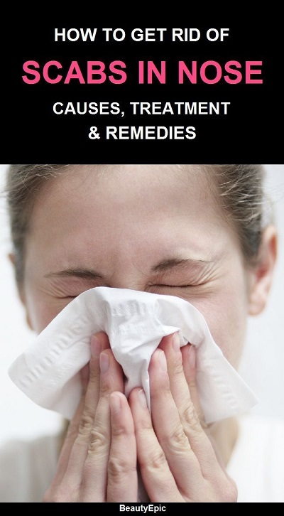 How To Get Rid Of Scabs In Nose, Causes, Treatment, Remedies In 2025