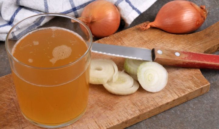 Onion Juice and Apple Cider Vinegar for Mole Removal