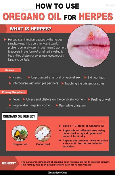 Oregano Oil For Herpes