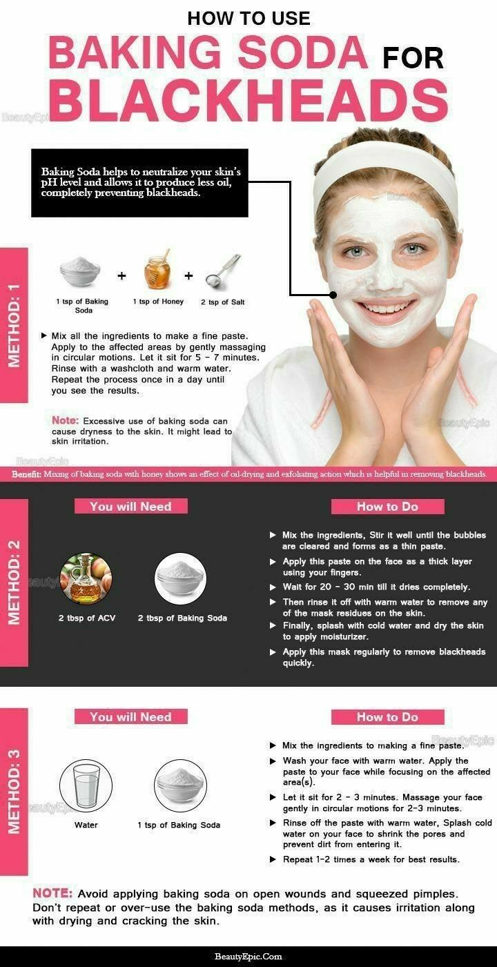 baking soda for blackheads