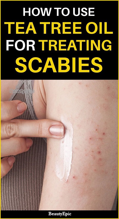 How To Use Tea Tree Oil For Scabies