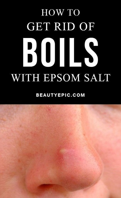 Is Epsom Salt Good For Boils