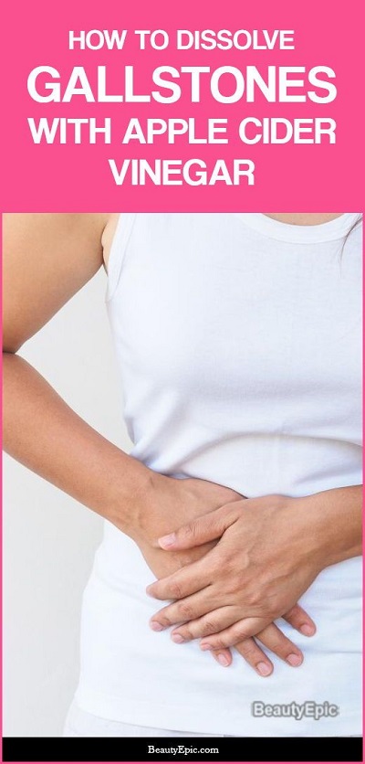 Does Apple Cider Vinegar Soften Gallbladder Stones