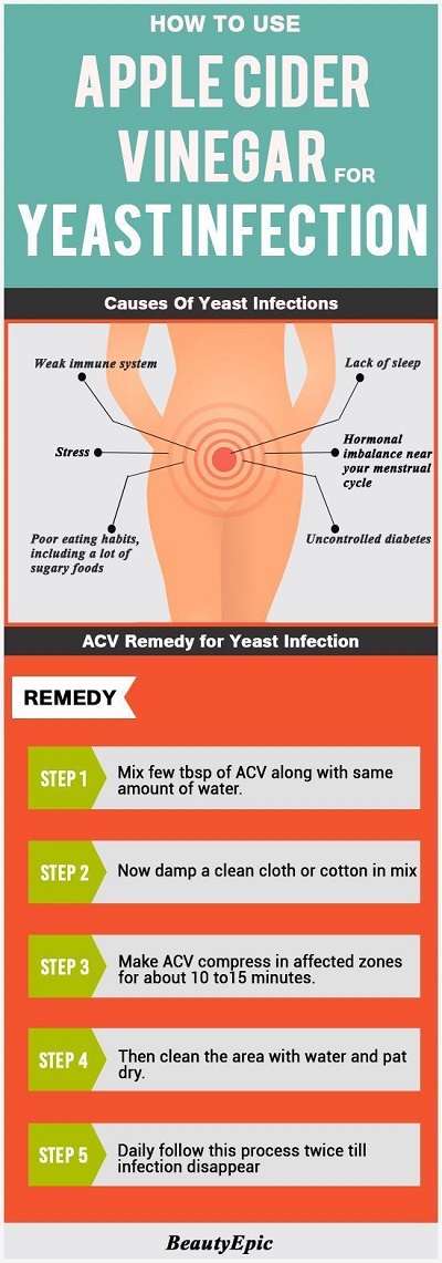 Does Apple Cider Vinegar Cure A Yeast Infection