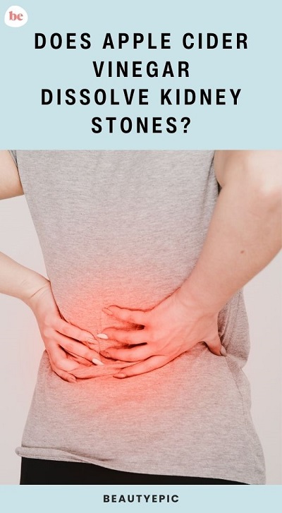 Apple Cider Vinegar for Kidney Stones