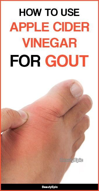 Apple Cider Vinegar for Gout