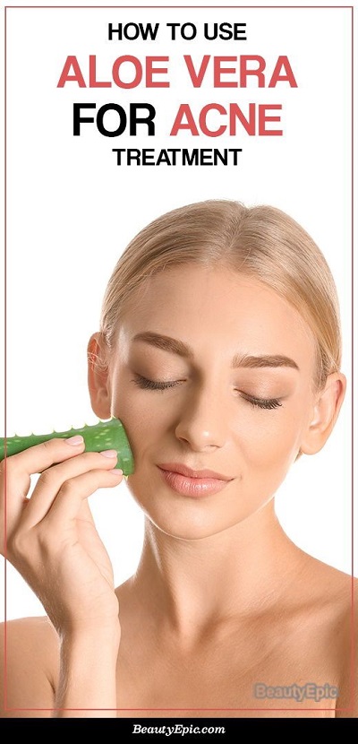 How to Use Aloe Vera for Acne Treatment