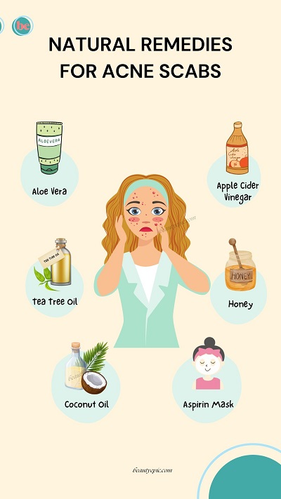 home remedies for acne scabs
