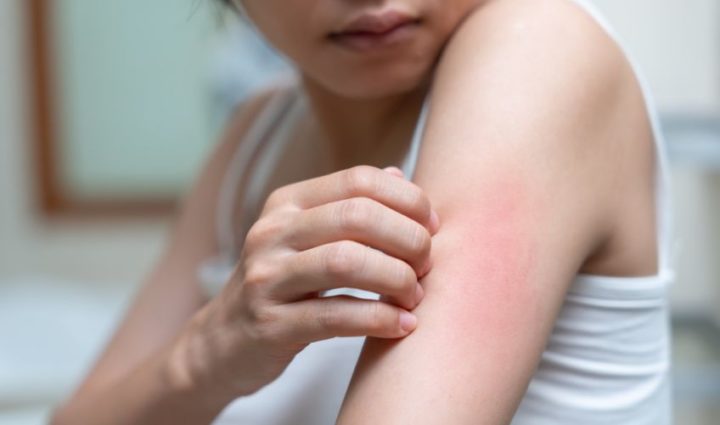 Skin Problems