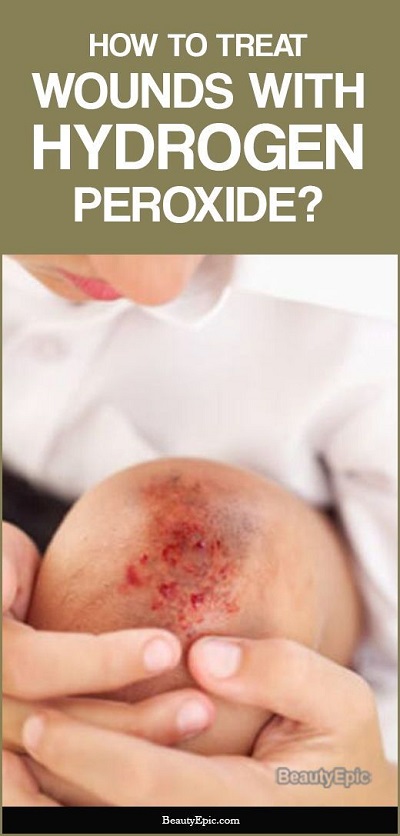 How To Treat Wounds With Hydrogen Peroxide