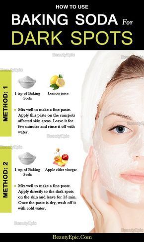 baking soda for dark spots
