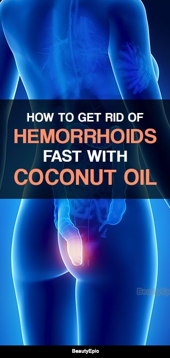 Does Coconut Oil Work For Hemorrhoids