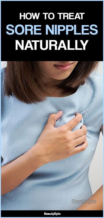 7 Simple Ways To Treat & Prevent Sore Nipples At Home