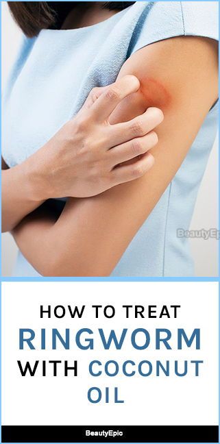 How To Use Coconut Oil For Ringworm Cure