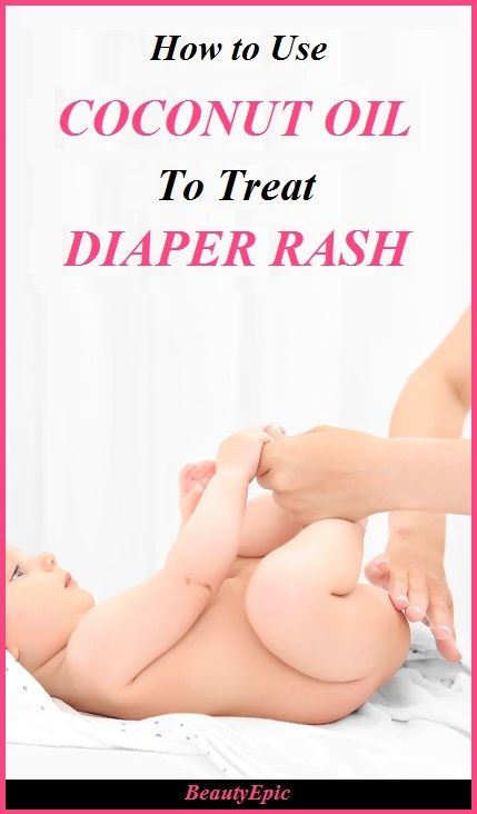 Coconut Oil For Diaper Rash