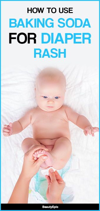 Baking Soda For Diaper Rash