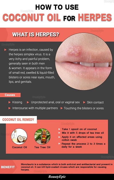 How To Use Coconut Oil For Herpes