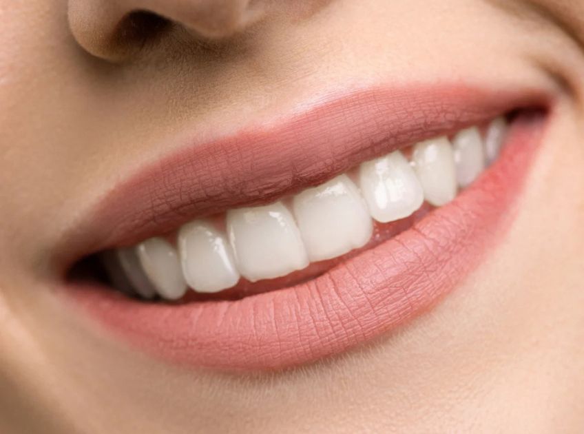 How to Whiten Teeth with Coconut Oil