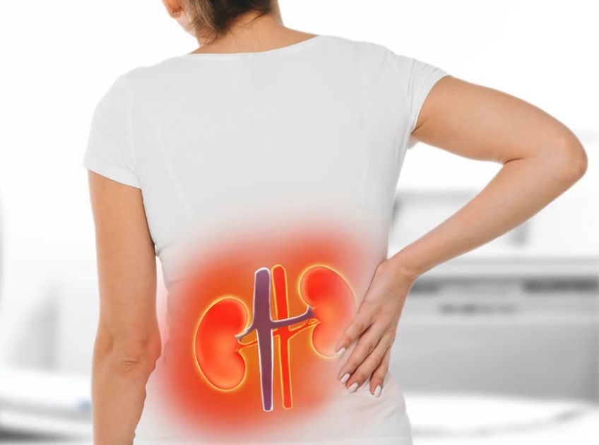 How to Dissolve Kidney Stones Quickly with Baking Soda