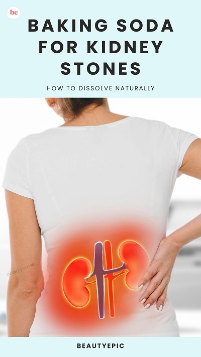 Baking Soda for kidney stones