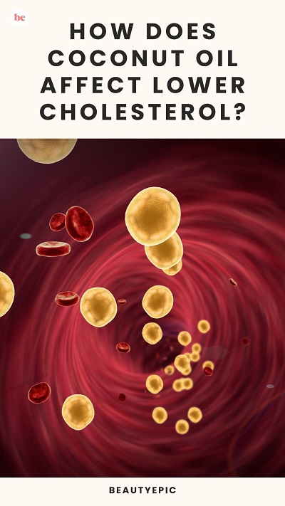 Coconut oil for Lower Cholesterol