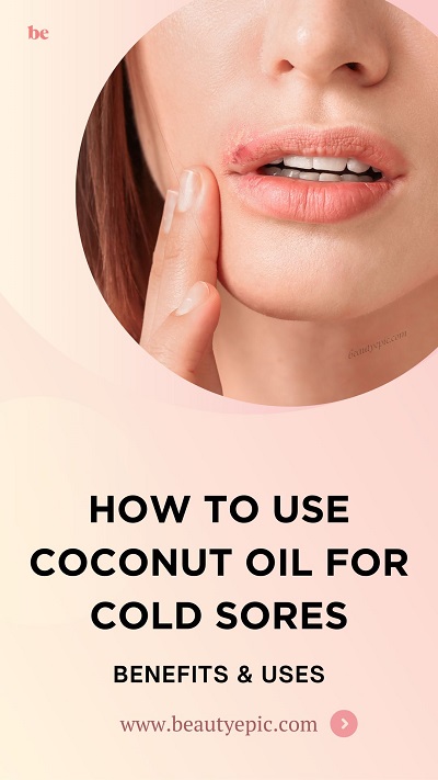 Coconut oil for Cold Sores