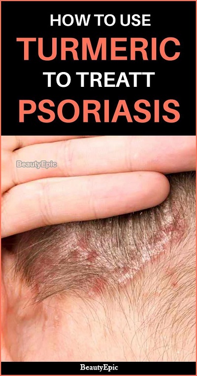 How To Use Turmeric For Psoriasis