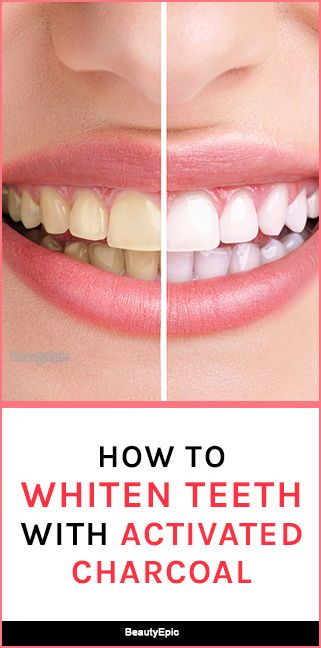 How To Use Activated Charcoal For Teeth Whitening