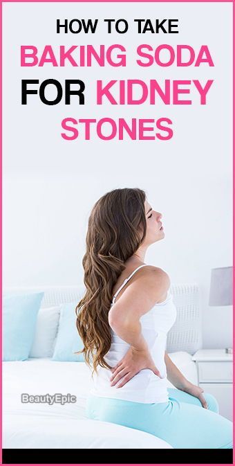 How To Dissolve Kidney Stones Quickly With Baking Soda