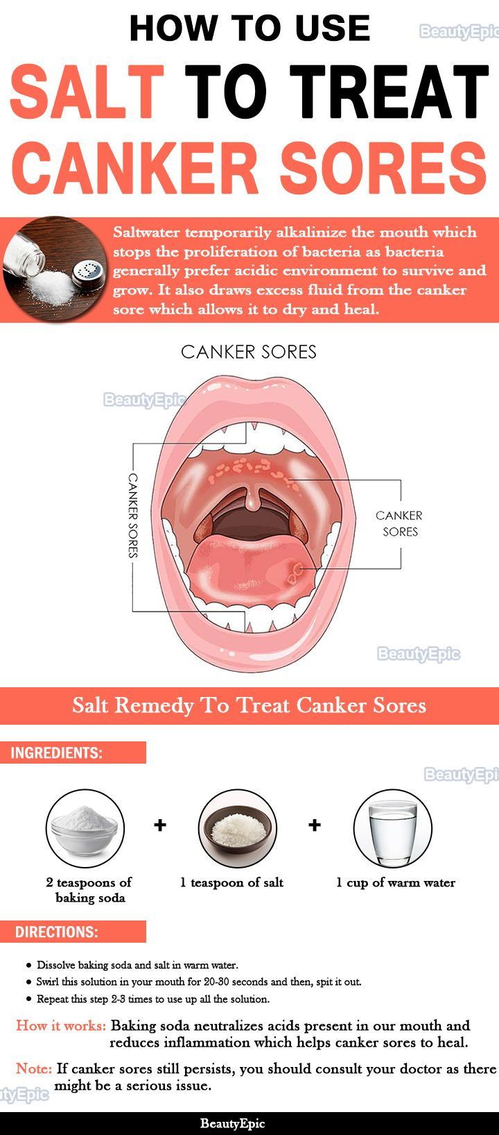 salt for canker sore