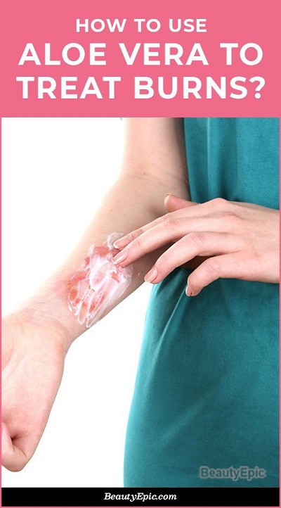 How to Use Aloe Vera for Burns