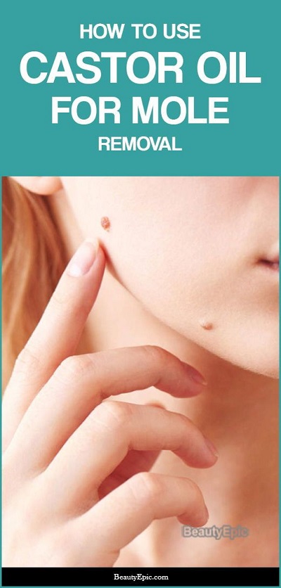 How To Use Castor Oil For Moles Removal