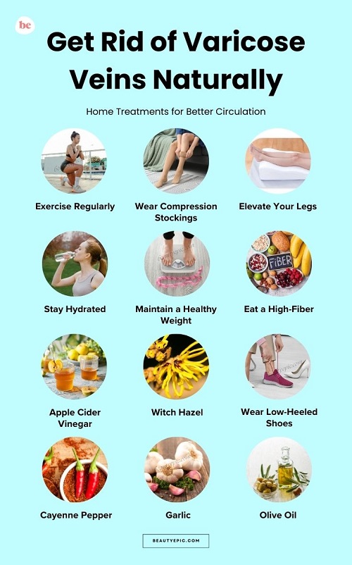 Get Rid of Varicose Veins Naturally