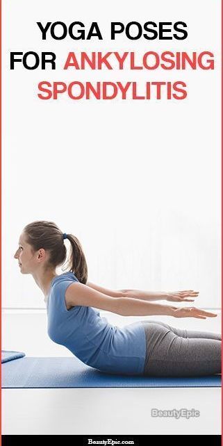 6 Effective Yoga Poses for Ankylosing Spondylitis