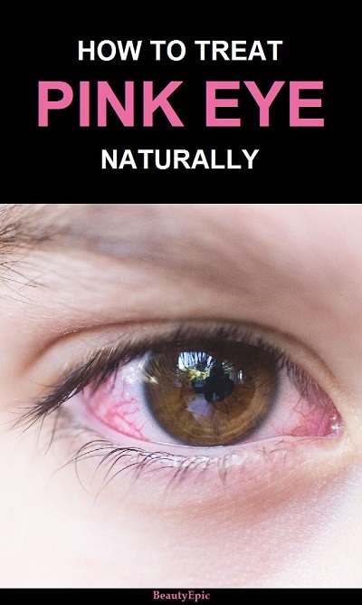 Pink Eye