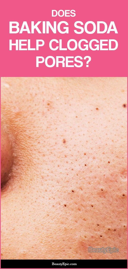 clogged pores baking soda