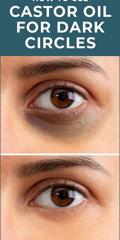 How To Use Castor Oil For Dark Circles