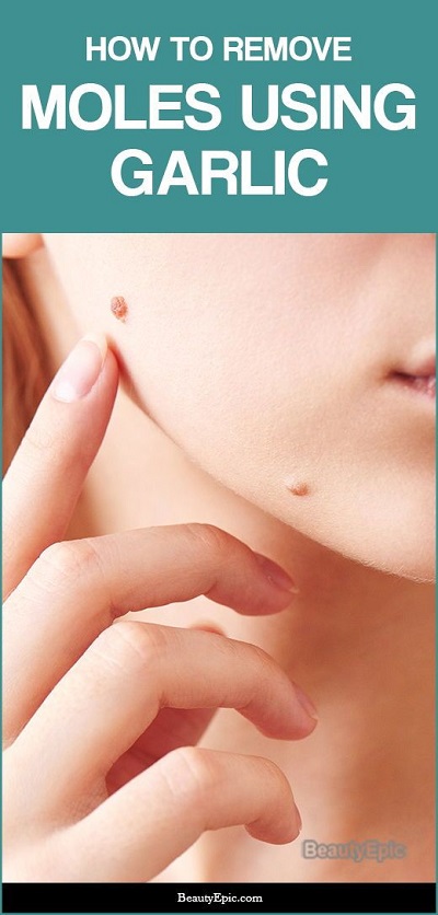 How To Use Garlic To Remove A Mole
