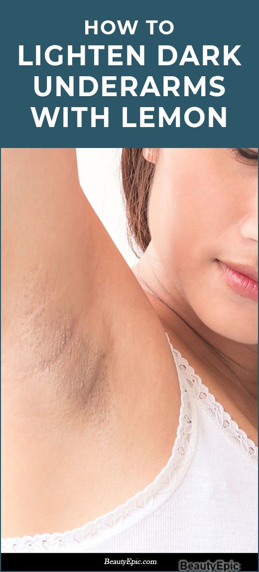 lemon juice for dark underarms