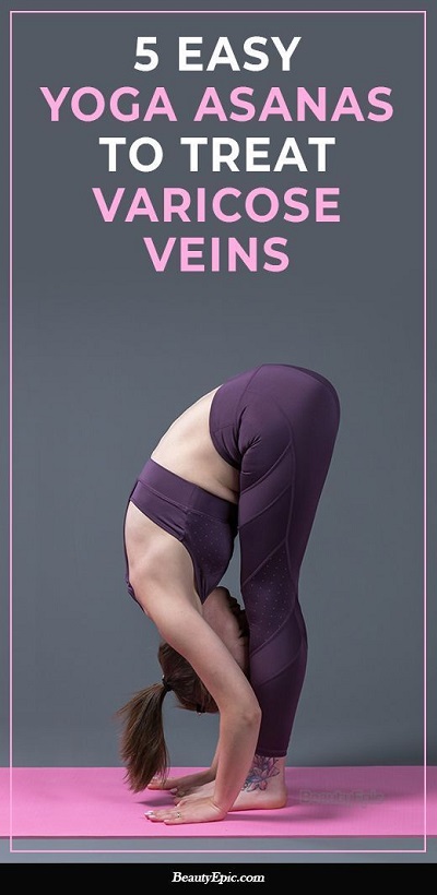 5 Effective Yoga Asanas to Treat Varicose Veins