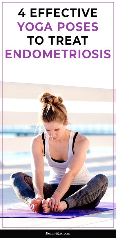 Yoga for Endometriosis Treatment