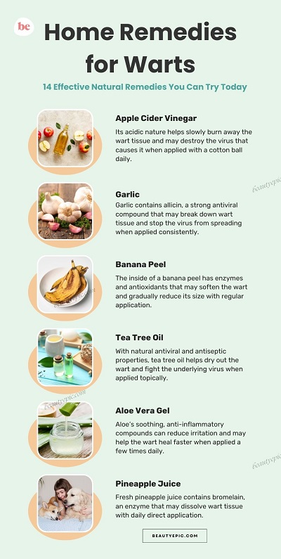 Home Remedies for Warts