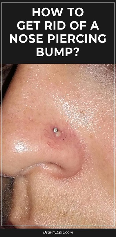 How to Get Rid of a Nose Piercing Bump