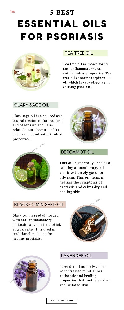 essential oils for psoriasis