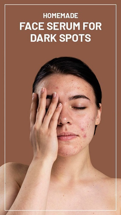 Homemade Face Serums for Dark Spots